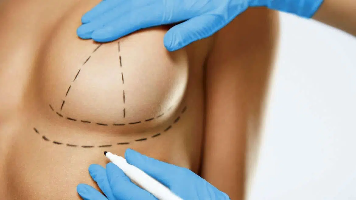 precio levantamiento de senos colombia