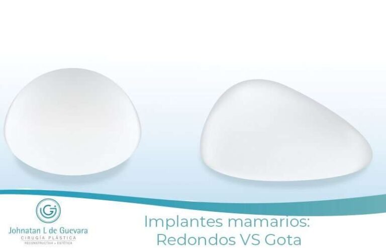 implantes anatómicos vs implantes redondos