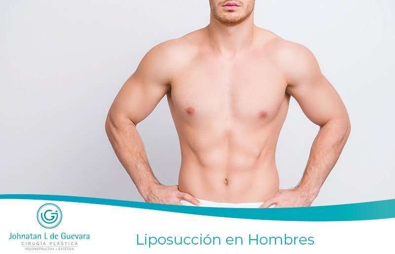 Liposucción en Hombres bogota
