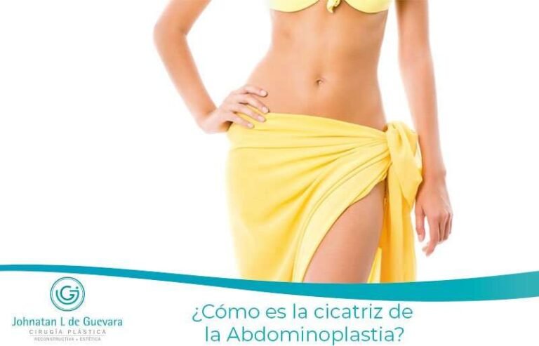 cicatriz de la Abdominoplastia