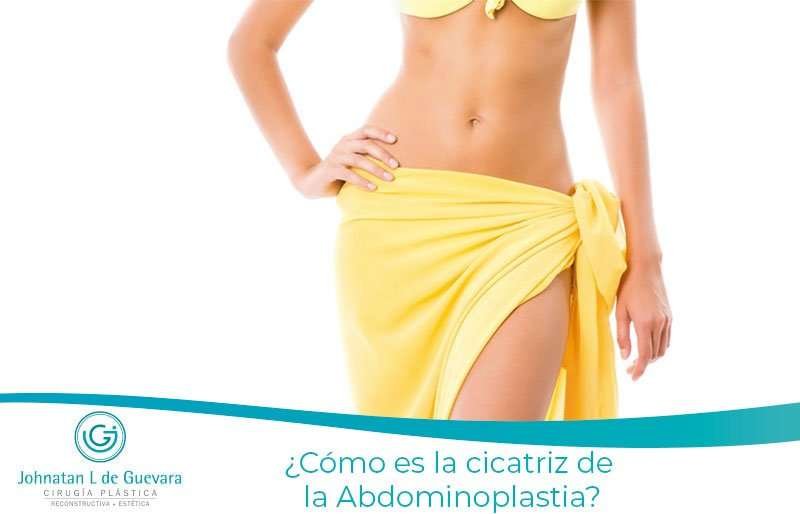 cicatriz de la Abdominoplastia