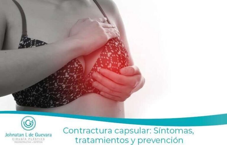 Contractura capsular: Síntomas, tratamientos y prevención