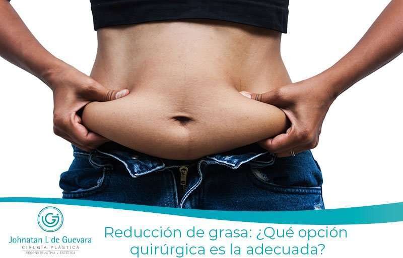 Reducción de grasa: ¿Qué opción quirúrgica es la adecuada?