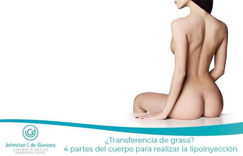 ¿Transferencia de grasa? 4 partes del cuerpo para realizar la lipoinyección