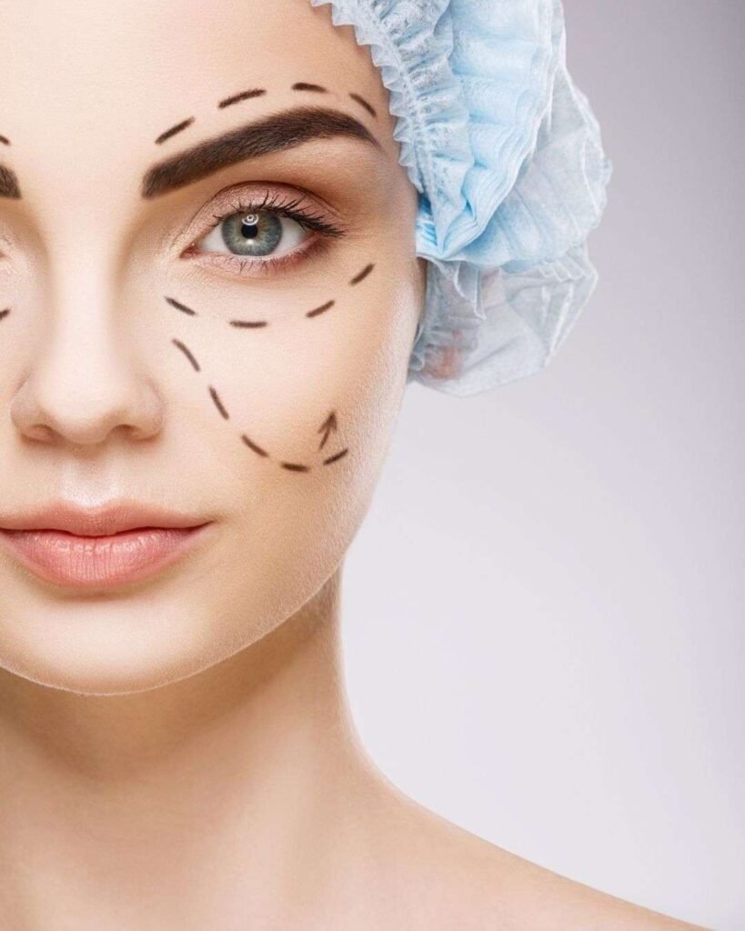 Bichectomia A 1 - Bichectomía en Bogotá