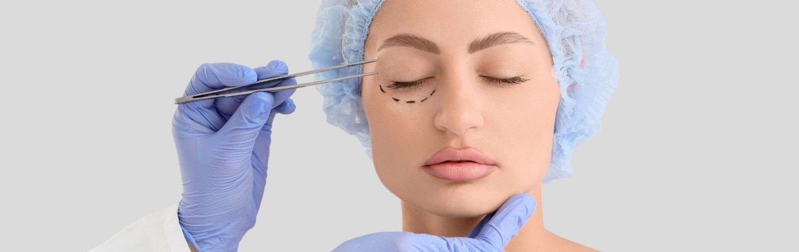 Blefaroplastia B - Eyelid Surgery in Colombia