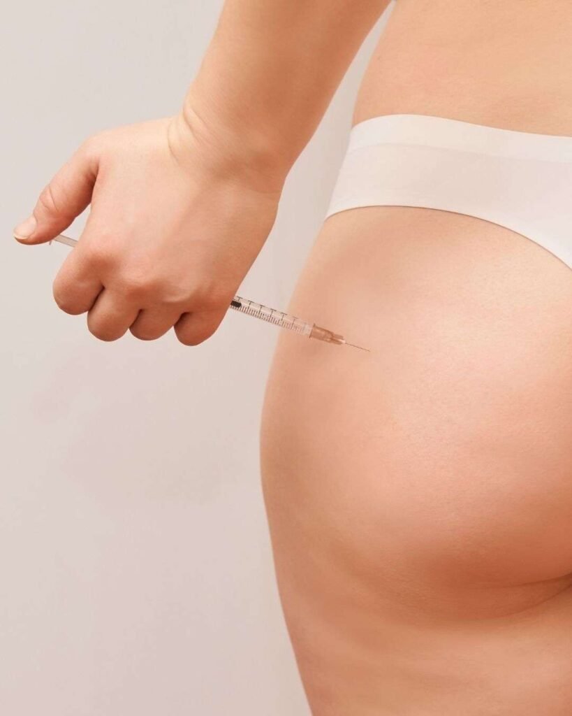 Lipoinyeccion Glutea A - Brazilian Butt Lift in Colombia