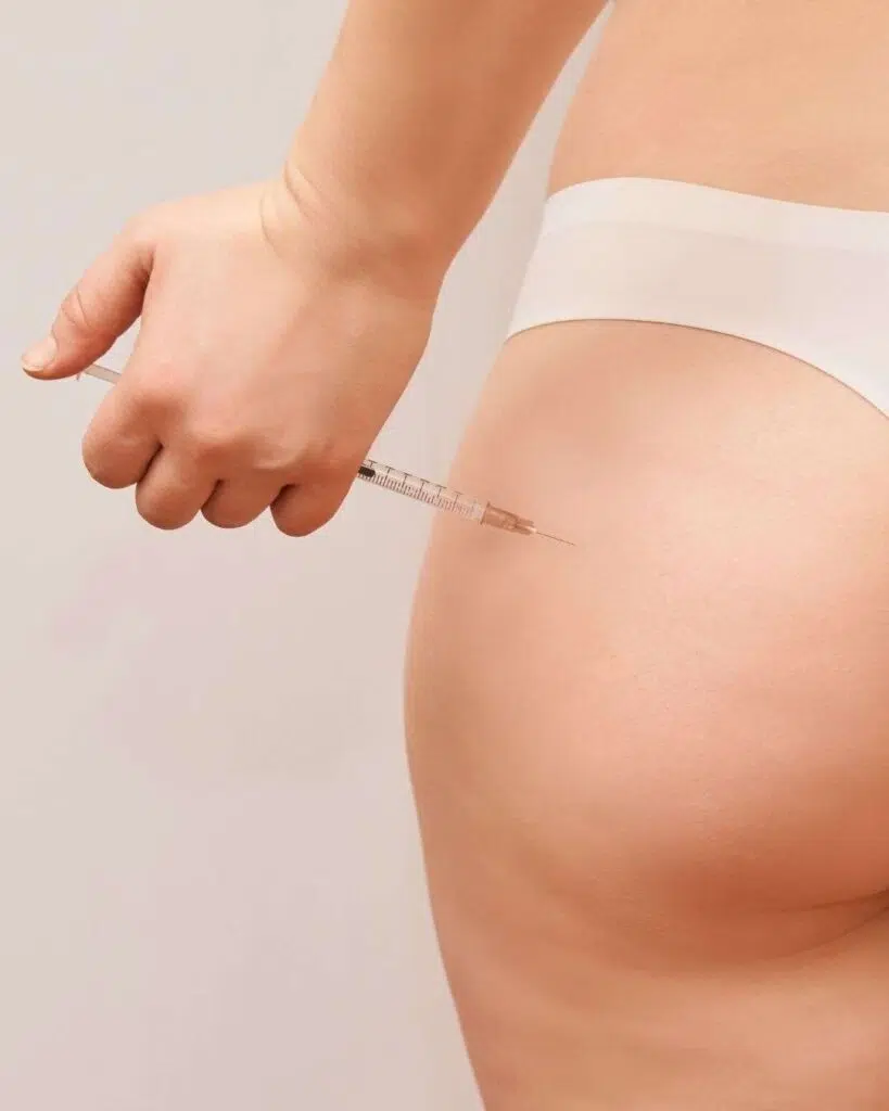 Lipoinyeccion Glutea A - Lipoinyección Glútea en Bogotá