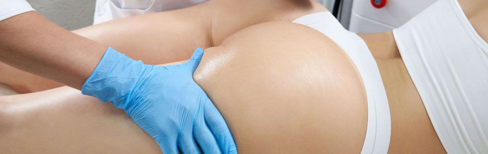 Gluteoplasty in Colombia 3 Lipoinyeccion Glutea E - Gluteoplasty in Colombia