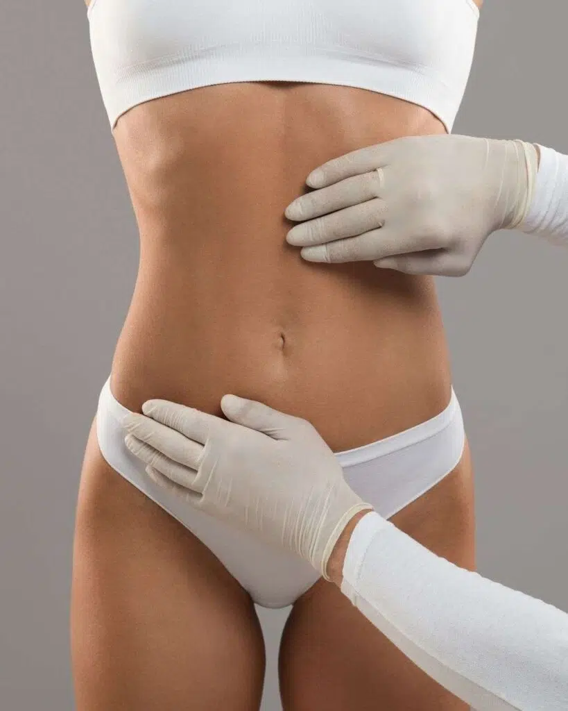 Cirugía lipolisis laser