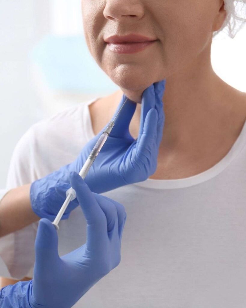 Chin Liposuction 2 Lipopapada A - Chin Liposuction