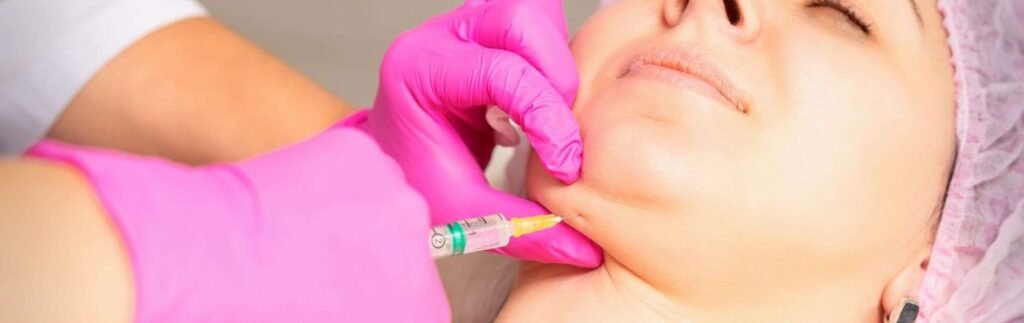 Chin Liposuction 3 Lipopapada D - Chin Liposuction