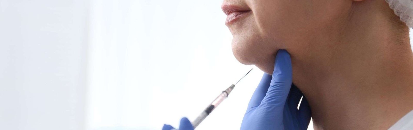 Chin Liposuction 4 Lipopapada E - Chin Liposuction