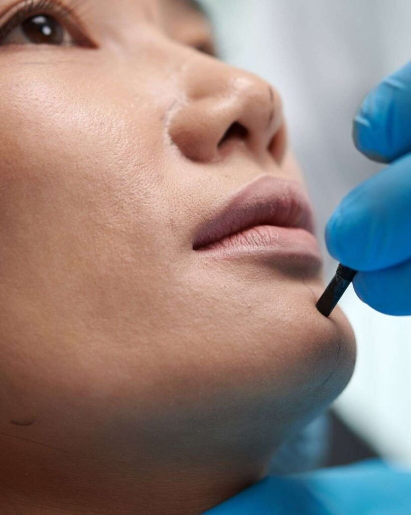 Mentoplastia A - Mentoplasty (Chin Surgery) in Colombia