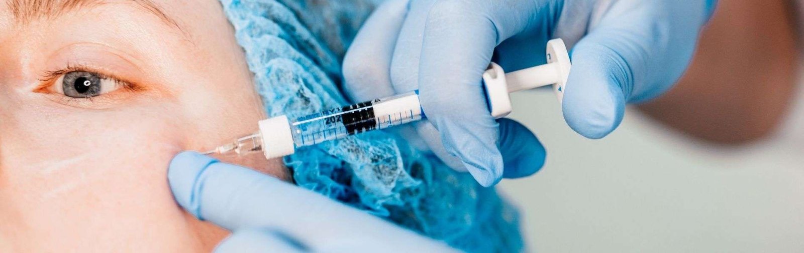 Cheekbone filler 4 Pomulos D - Cheekbone filler