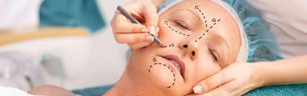 Rejuvenecimiento facial B - Rejuvenecimiento Facial en Bogotá