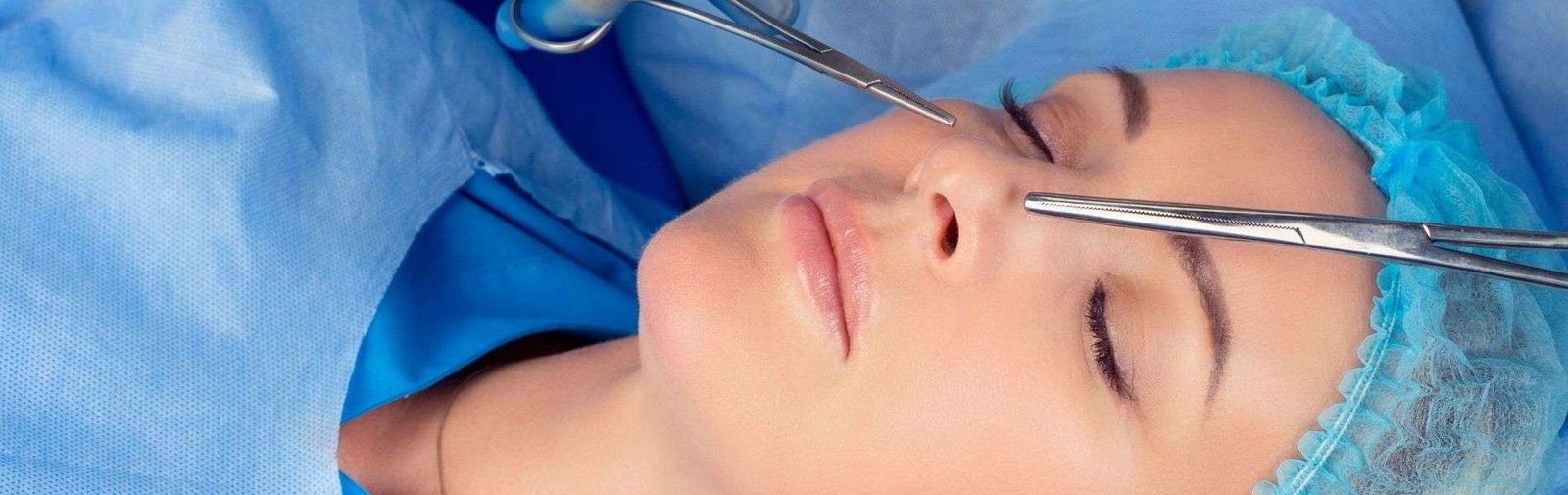 Rhinoplasty in Colombia 3 Rinoplastia D - Rhinoplasty in Colombia