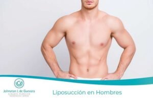Liposucción en Hombres bogota