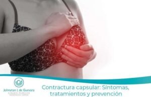 Contractura capsular: Síntomas, tratamientos y prevención