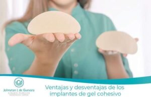 Ventajas y desventajas de los implantes de gel cohesivo