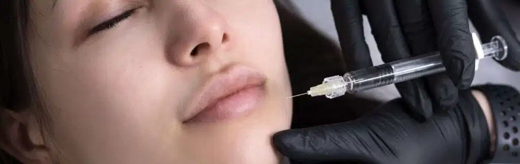Aumento de Labios 3 Aumento de Labios E - Aumento de Labios