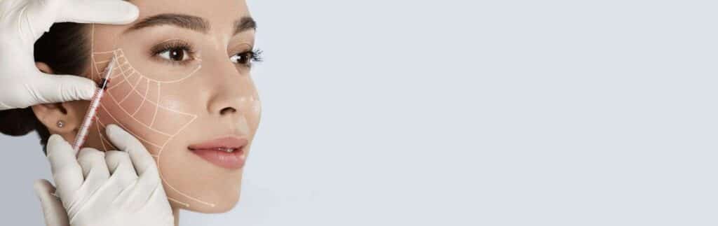 Facelift without surgery 3 Lifting Facial D 1 - Facelift without surgery