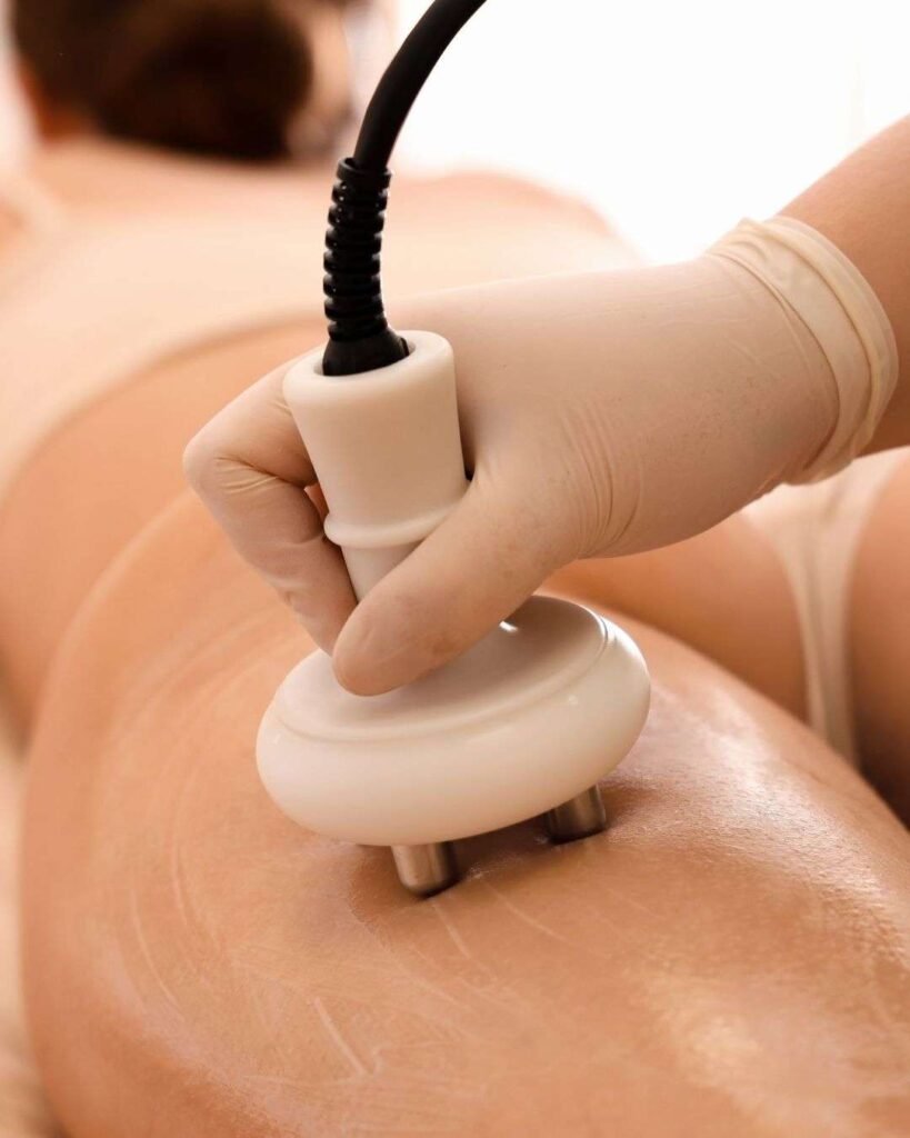 Cellulite treatment 2 Tratamiento Celulitis A - Cellulite treatment