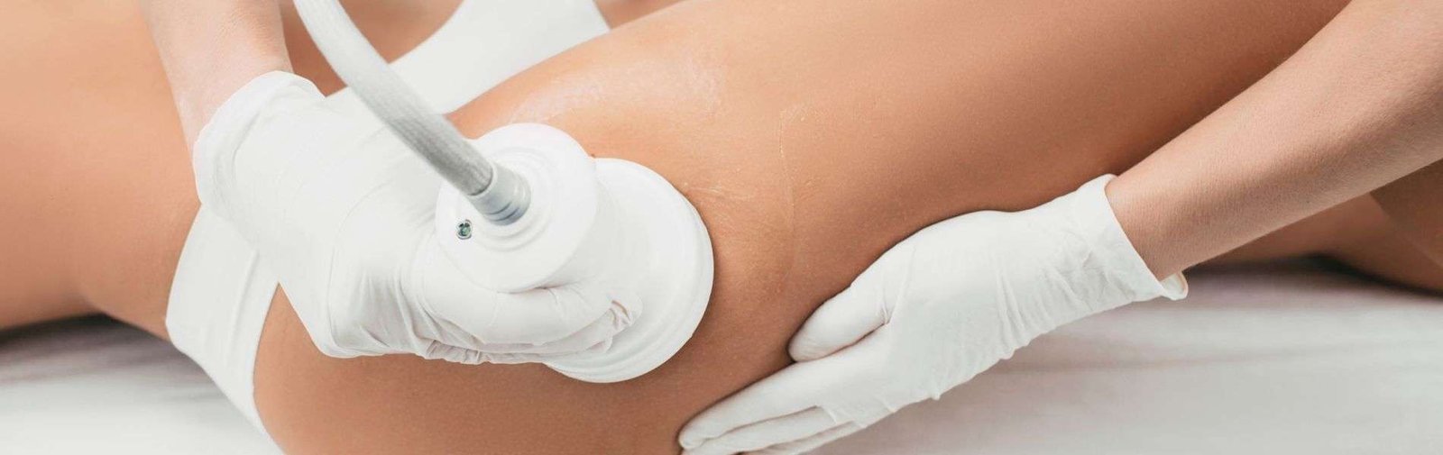 Cellulite treatment 4 Tratamiento Celulitis E - Cellulite treatment